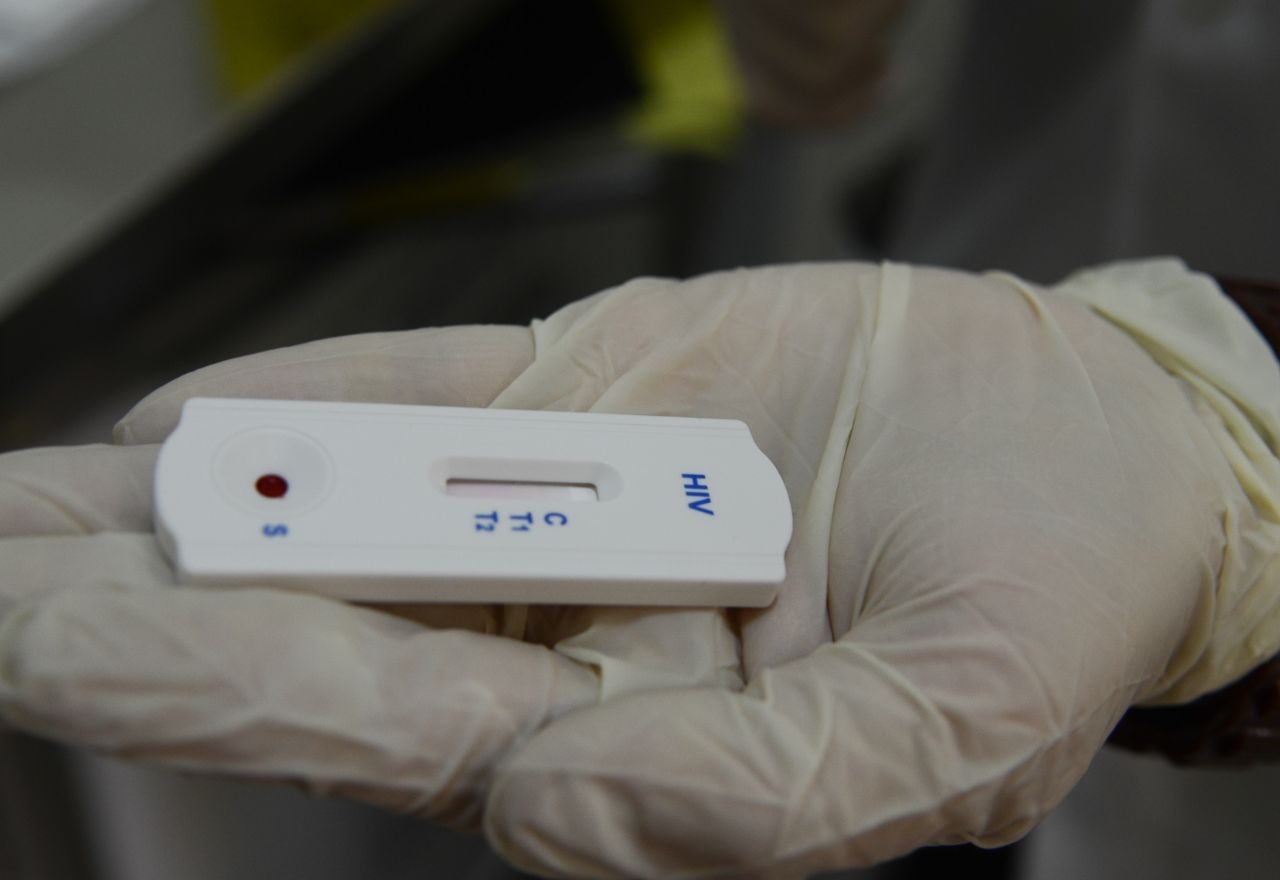 Imagem da noticia Seis pacientes transplantados receberam órgãos contaminados com HIV e foram infectados no RJ