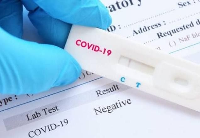 Imagem da noticia Maior reclamação na ANS  é a dificuldade para fazer teste da covid