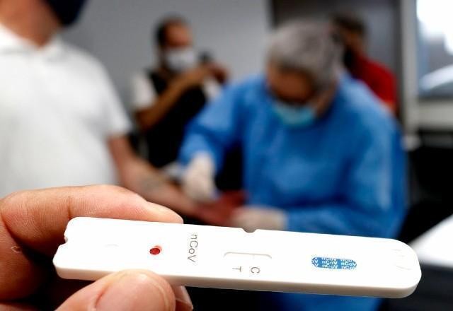 Imagem da noticia Brasil registra 11.587 novos casos de covid-19 em 24 horas