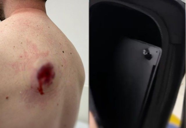 Ladrão atira nas costas de motociclista durante assalto e notebook na mochila impede ferimento grave na vítima — Foto: Divulgação/PM