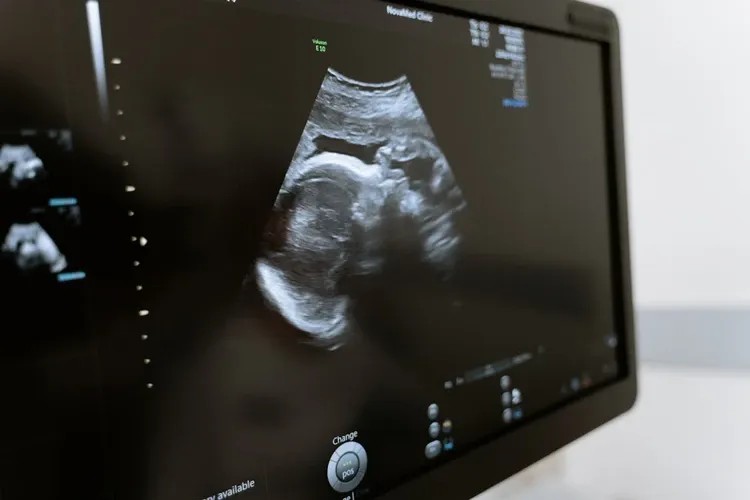 Imagem da noticia Pacheco diz que aborto é diferente de homicídio e defende discussão longa no Senado