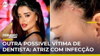 Dentista é investigado após morte de influenciador e complicações em atriz | #PrimeiroImpacto Dentista é investigado após morte de influenciador e complicações em atriz | #PrimeiroImpacto