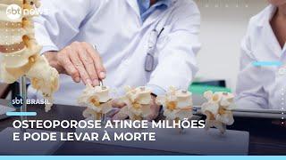 Osteoporose atinge 15 milhões de brasileiros e pode levar à morte, alertam médicos | #SBTBrasil Osteoporose atinge 15 milhões de brasileiros e pode levar à morte, alertam médicos | #SBTBrasil