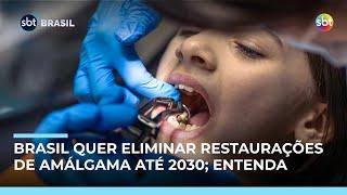 Ministério da Saúde quer eliminar udo de restaurações de amálgama até 2030; entenda Ministério da Saúde quer eliminar udo de restaurações de amálgama até 2030; entenda