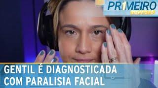 Paralisia de Bell: doença afeta a jornalista Fernanda Gentil; entenda | Primeiro Impacto (28/02/24)