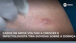 Brasil registra novos casos de Mpox em 2026 e acende alerta na saúde pública | #NewsSábado Brasil registra novos casos de Mpox em 2026 e acende alerta na saúde pública | #NewsSábado