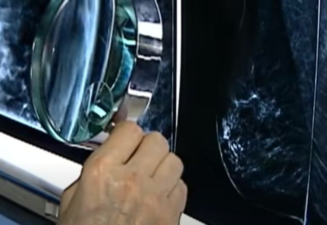 Imagem da noticia Apenas 1 em 4 pacientes recebem tratamento adequado contra o câncer