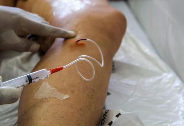 Imagem da noticia A cada dia, 145 mulheres são internadas para tratar varizes