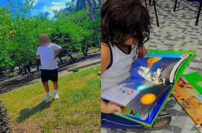 Aluno de 10 anos perde visão de um olho após sofrer bullying em escola no RJ Aluno de 10 anos perde visão de um olho após sofrer bullying em escola no RJ