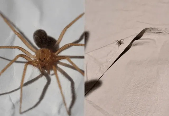 Imagem da noticia Aranha-marrom: Mulher tem necrose na pele após picada e é internada em Santa Catarina