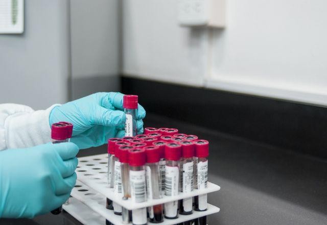 Imagem da noticia Número de casos suspeitos de hepatite desconhecida chega a 49 no Brasil