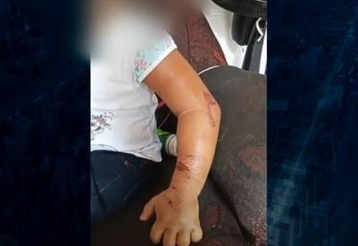 Mãe e madrasta são presas suspeitas de espancar criança de 4 anos Mãe e madrasta são presas suspeitas de espancar criança de 4 anos