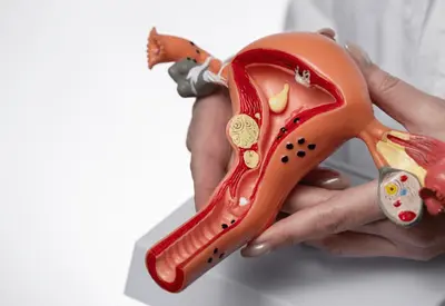 Sinais que o corpo dá: como reconhecer cedo o câncer no útero e nos ovários Sinais que o corpo dá: como reconhecer cedo o câncer no útero e nos ovários