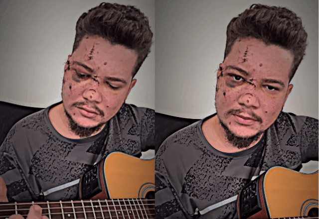 Imagem da noticia Cantor sertanejo agredido com uma garrafada em show faz 1ª publicação após ter alta