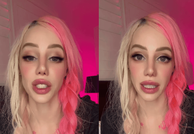 Imagem da noticia Cantora diz que está com osteoporose pelo uso de Ozempic; por que isso pode acontecer?