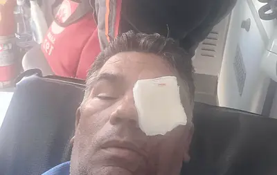 Motorista é agredido por passageiro após negar desembarque fora do ponto no DF Motorista é agredido por passageiro após negar desembarque fora do ponto no DF