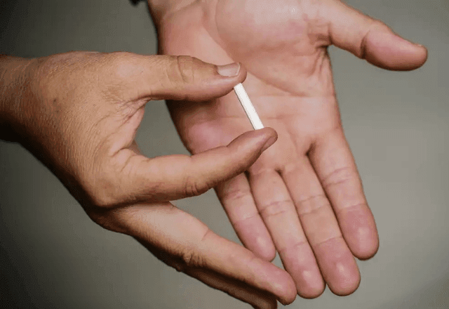 Imagem da noticia Anvisa libera implantes hormonais — exceto os “chips da beleza”; entenda