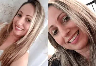 Professora ferida por ex-aluno de escola em Suzano (SP) perdeu um dedo da mão, diz marido Professora ferida por ex-aluno de escola em Suzano (SP) perdeu um dedo da mão, diz marido