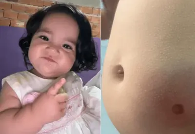 Bebê de 11 meses sobrevive a bala perdida em SP e mãe celebra: 'Milagre' Bebê de 11 meses sobrevive a bala perdida em SP e mãe celebra: 'Milagre'