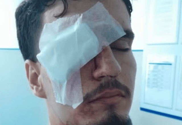 Imagem da noticia Estudante perde visão de um olho atingido por bala de borracha na saída do Maracanã