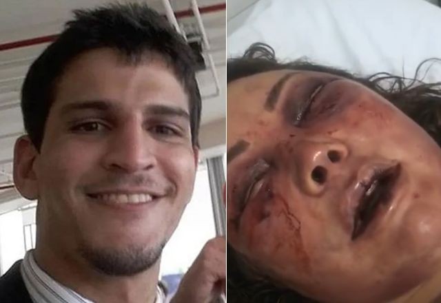 Imagem da noticia Agressor de paisagista cometeu crime durante sono e não pode ser responsabilizado, diz Justiça