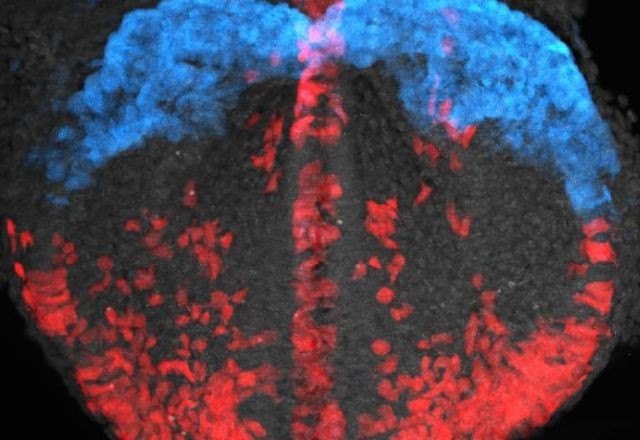Imagem da noticia Como um coração é formado? Pesquisadores filmam desenvolvimento do órgão pela primeira vez