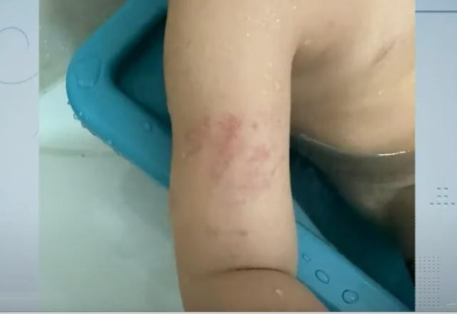 Imagem da noticia Criança autista é agredida por educadora dentro de escola particular