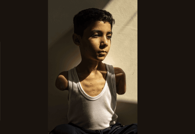 Imagem da noticia Criança palestina que perdeu os braços em ataque a Gaza é eleita foto do ano pela World Press Photo