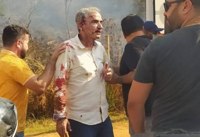 Imagem da noticia Helicóptero com deputado federal atinge rede elétrica e cai no interior de MG