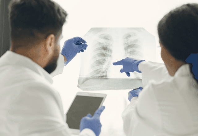 Imagem da noticia Câncer de pulmão: como o diagnóstico precoce pode aumentar as chances de cura?