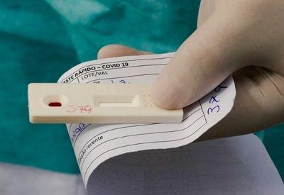 Positividade para covid no Brasil sobe de 29% para 35% em uma semana Positividade para covid no Brasil sobe de 29% para 35% em uma semana