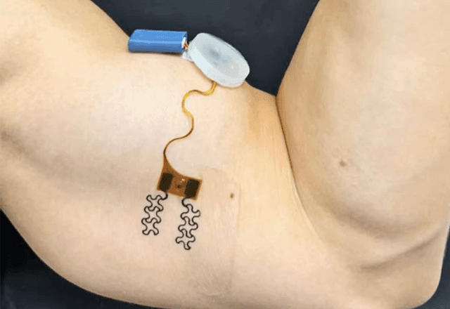 Imagem da noticia Estou desidratado? Sensor vestível pode dizer quando você precisa de água; entenda