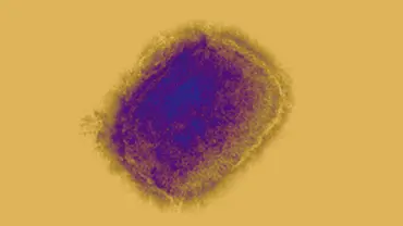 SP registra segundo caso de nova variante de Mpox SP registra segundo caso de nova variante de Mpox