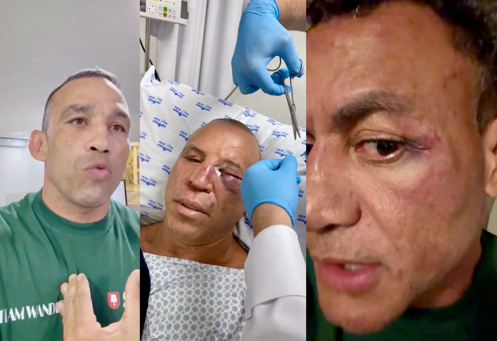 Imagem da noticia Wanderlei Silva, Popó e Werdum: veja versões sobre briga generalizada após luta