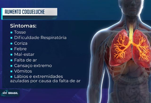 Imagem da noticia Ministério da Saúde reforça cuidados com a coqueluche