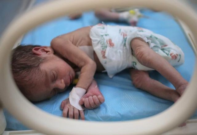 Imagem da noticia Restrição de Israel à ajuda para Gaza pode equivaler a crime de guerra, diz ONU