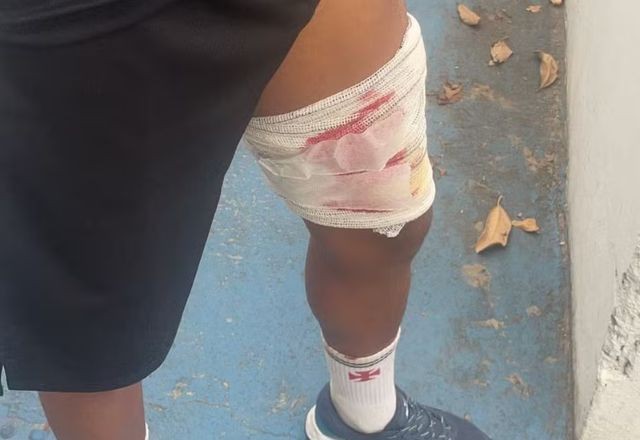 Imagem da noticia Jovem grava momento em que é atingido por bala perdida enquanto corria no Rio de Janeiro