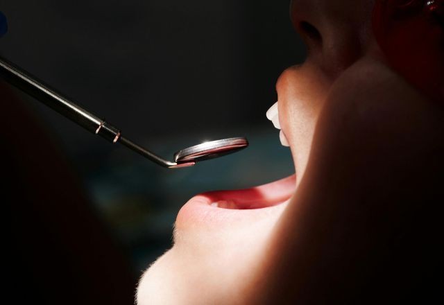 Imagem da noticia Saúde bucal: o que os dentes revelam sobre o corpo?