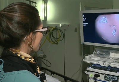 Câncer de intestino deve ter 145 novos casos por dia no Brasil em 2026 Câncer de intestino deve ter 145 novos casos por dia no Brasil em 2026