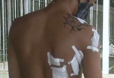 Rapaz leva 10 facadas ao defender amiga de ataque do ex-namorado Rapaz leva 10 facadas ao defender amiga de ataque do ex-namorado