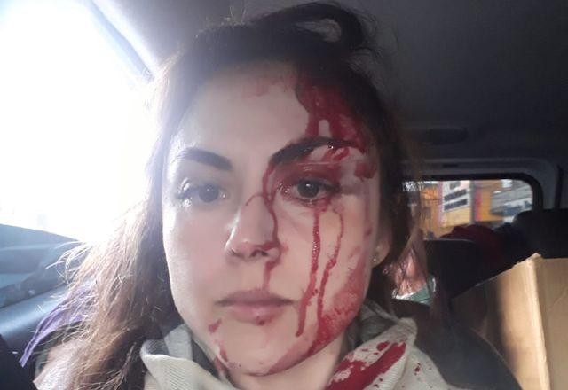 Imagem da noticia Procurador espanca colega de trabalho
