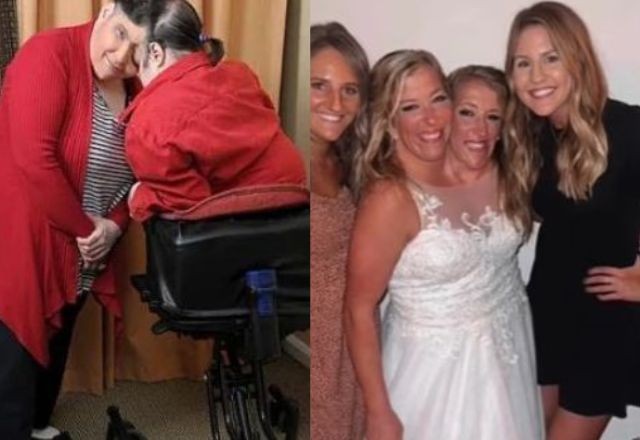 Imagem da noticia Por que existem gêmeos siameses? Entenda