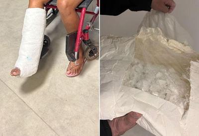 Mulher é presa com 3kg de cocaína escondida em gesso na perna Mulher é presa com 3kg de cocaína escondida em gesso na perna