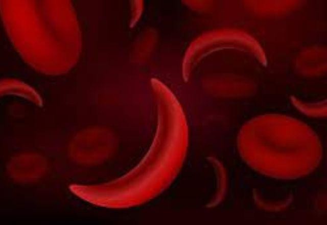 Imagem da noticia EUA aprovam terapias de edição genética para tratar anemia falciforme