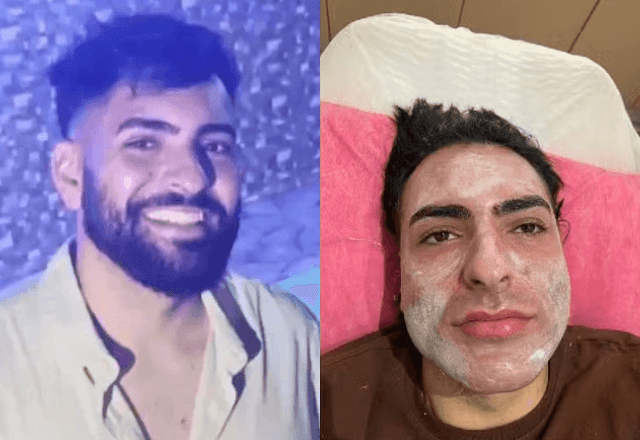 Imagem da noticia Peeling de fenol: mãe de empresário morto em procedimento pede indenização de R$ 1,4 milhão