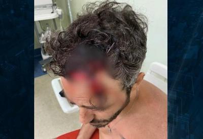 Agressão a ator: polícia trabalha com três linhas de investigação Agressão a ator: polícia trabalha com três linhas de investigação