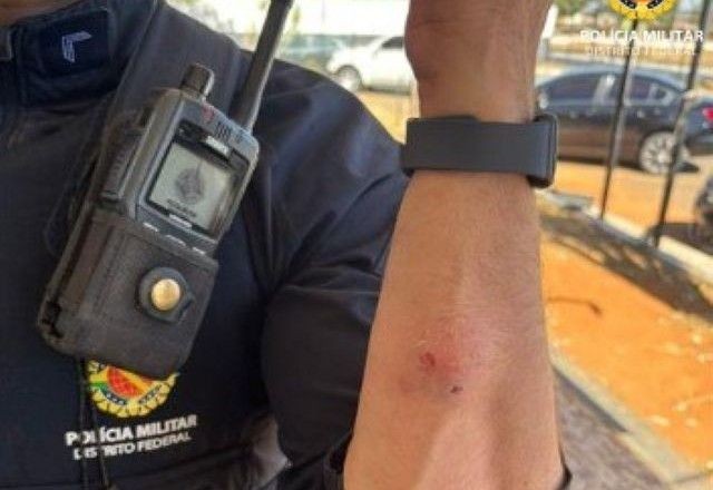 Imagem da noticia Policial militar do DF é mordido durante abordagem a homem que descumpriu medida protetiva