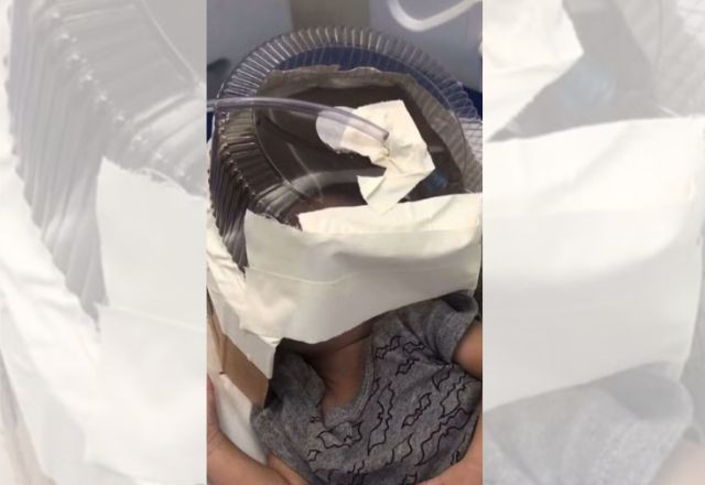 Imagem da noticia Hospital usa embalagem de bolo como máscara de oxigênio em bebê