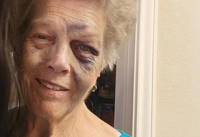 Criminoso espanca idosa, rouba carro e morre em acidente de trânsito depois Criminoso espanca idosa, rouba carro e morre em acidente de trânsito depois