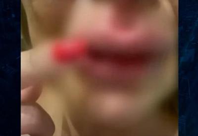 Família revela lesões de Silvye Alves, apresentadora agredida pelo ex Família revela lesões de Silvye Alves, apresentadora agredida pelo ex